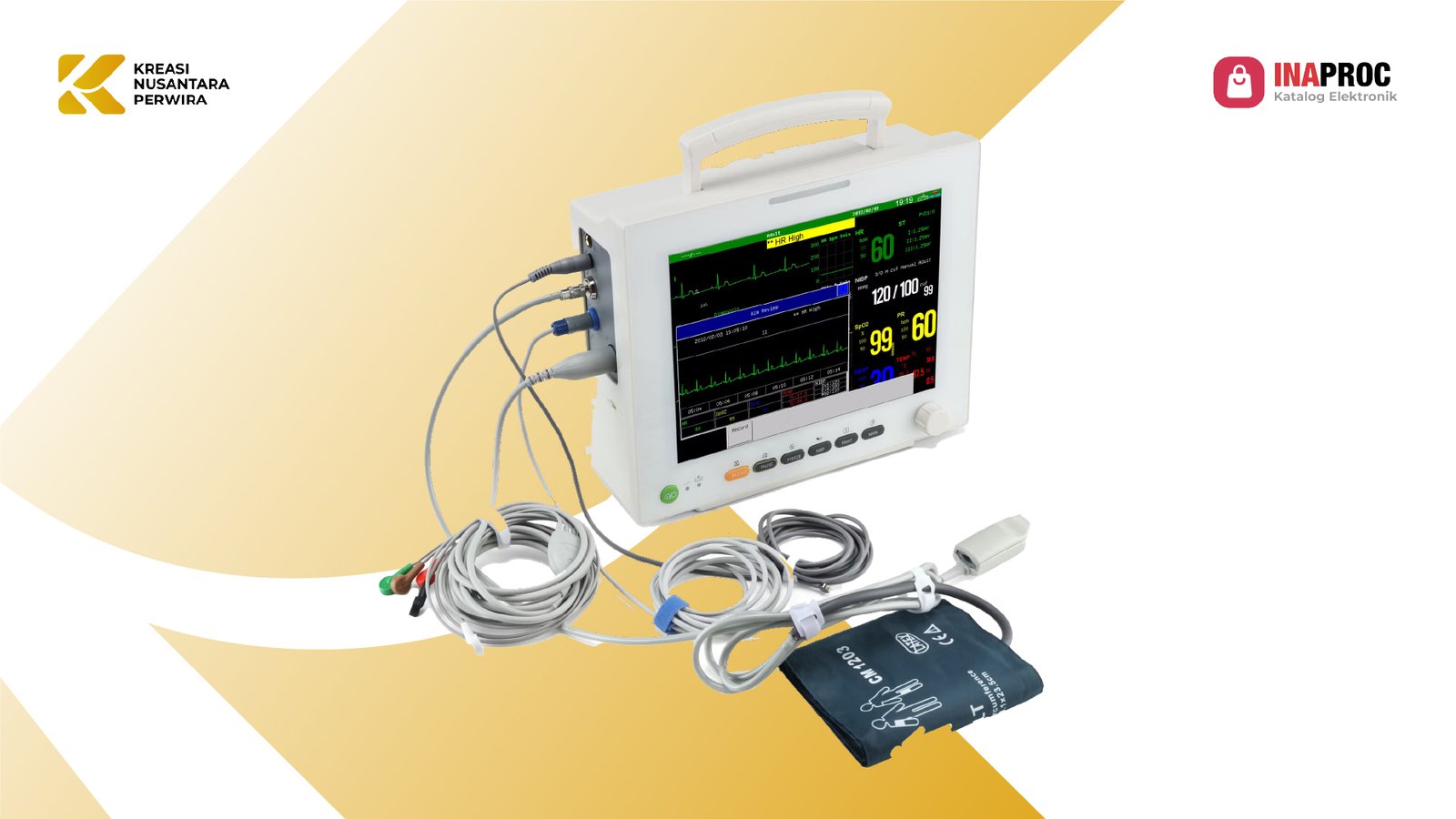 Patient Monitor